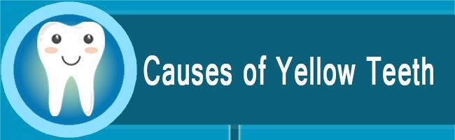 Causes of stained teeth