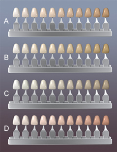 tooth color