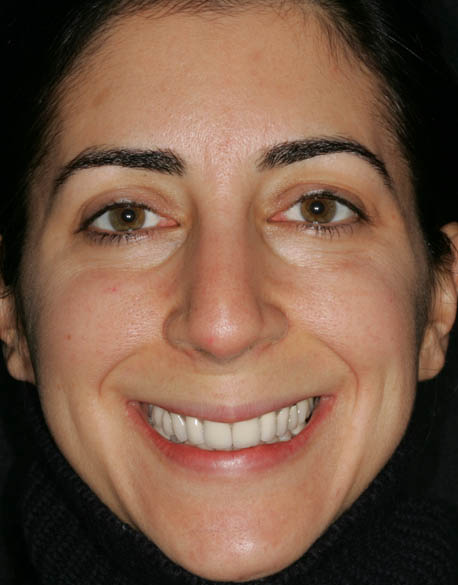  Before & After Photo